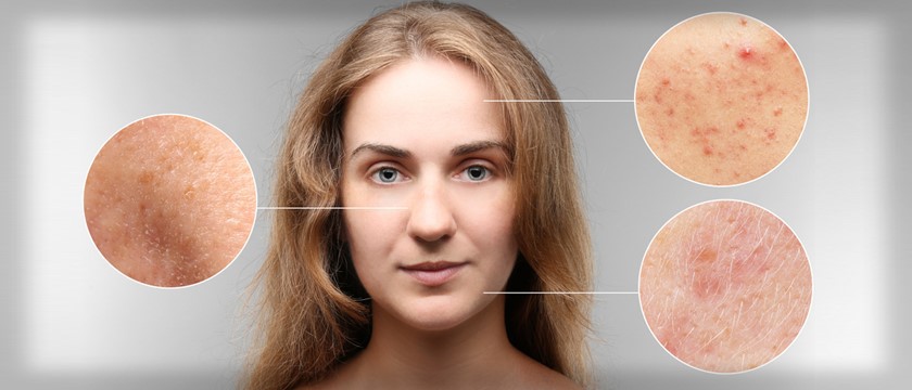 شایع ترین بیماری های پوستی